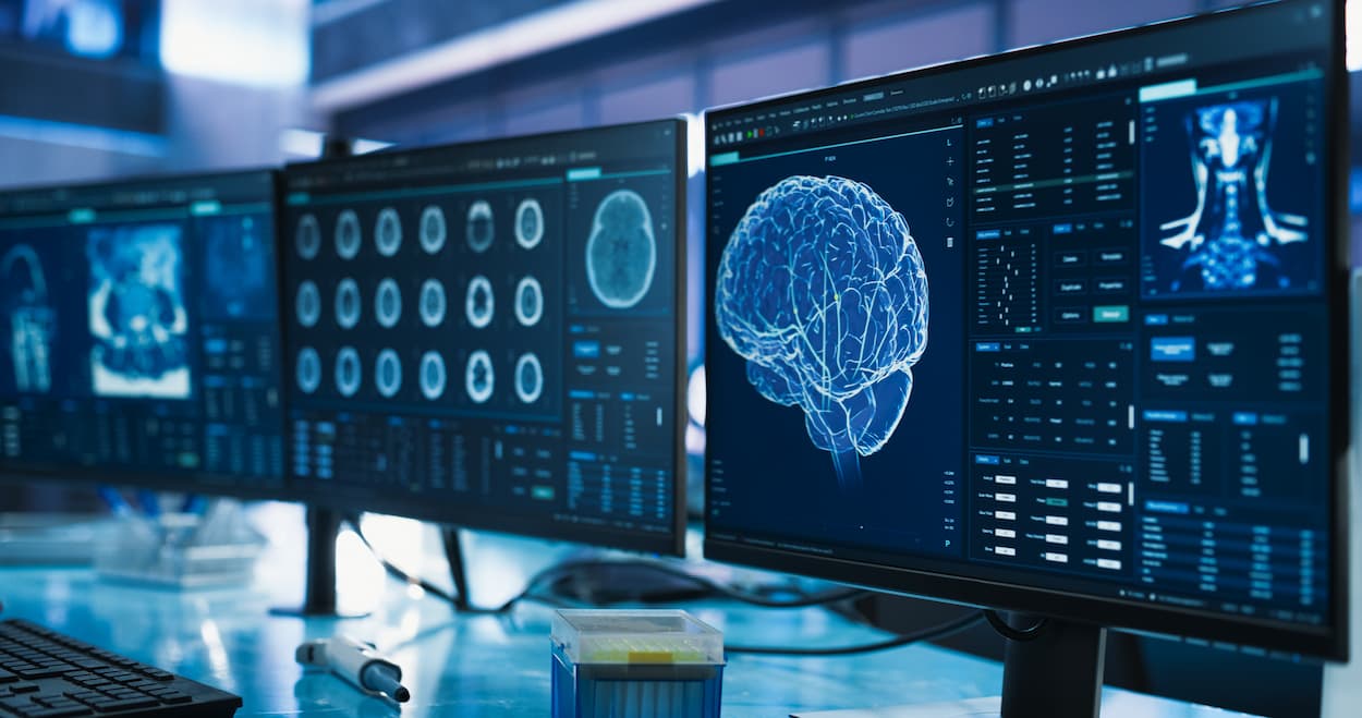 Brain Anatomy and How the Brain Works: Advanced technology and data analytics illuminate the complexities of neural function.